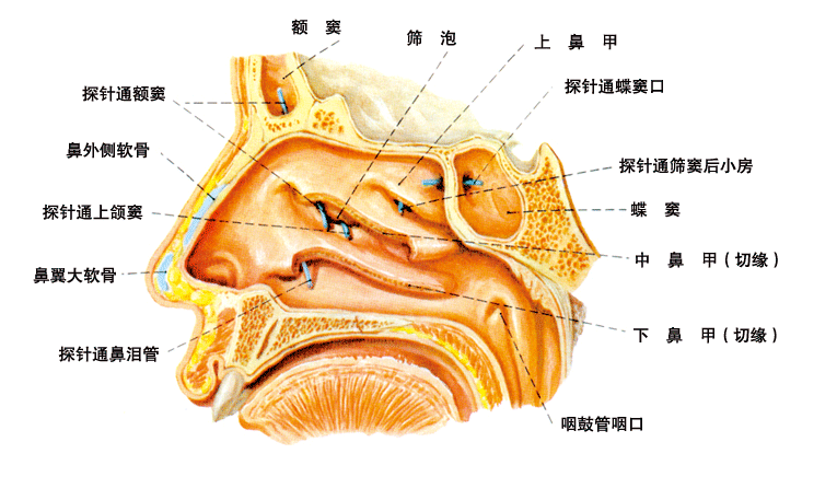 面部窦道图片